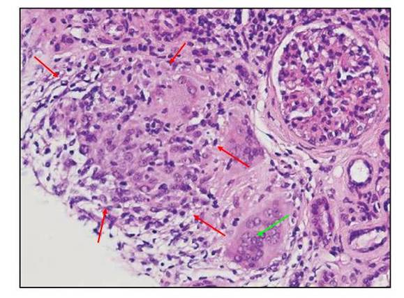 考研肿内肾内如何选？-图2