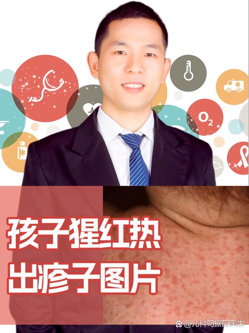 猩红热出现在哪章节？-图2