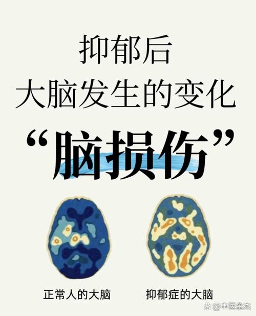 思维形式障碍有哪些典型症状？-图2